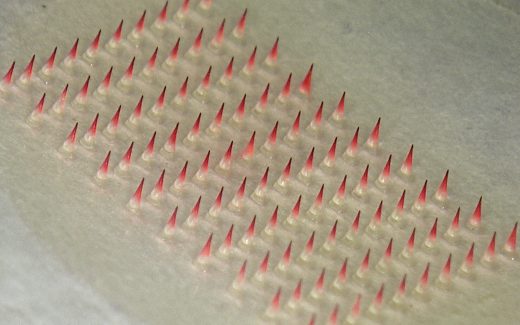 Microneedles Thermage